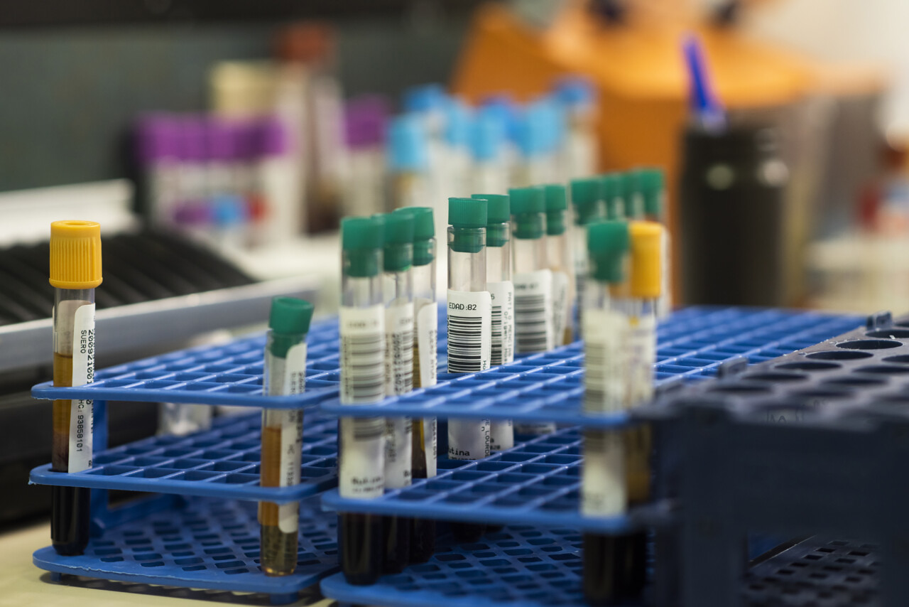 etykiety farmaceutyczne na probówki